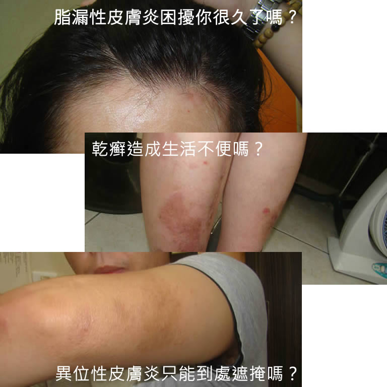 廣和中醫皮膚科門診